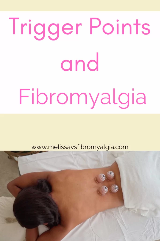 trigger points and fibromyalgia